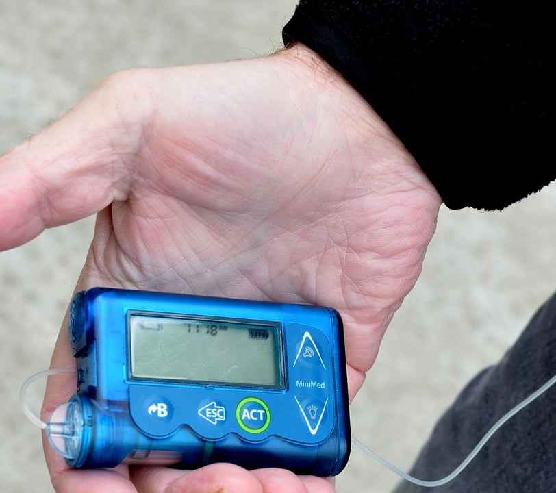 Инсулиновая помпа: недостатки гаджета для диабетиков
