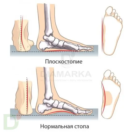 Стельки ортопедические каркасные TRIO winter FW-607